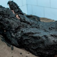 Лечение в санаториях
