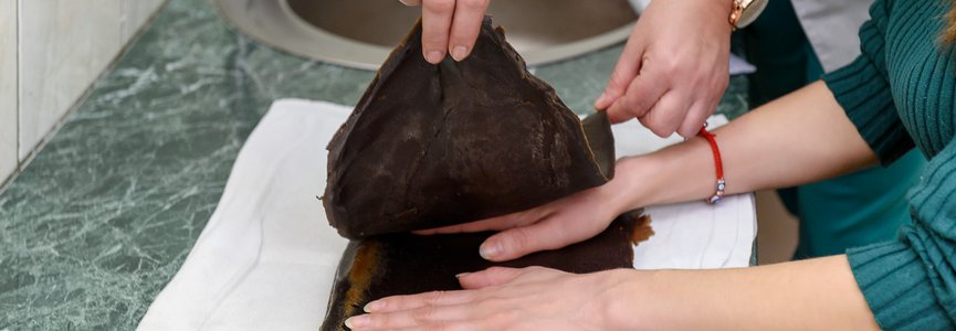 Заболевания сердечно-сосудистой системы